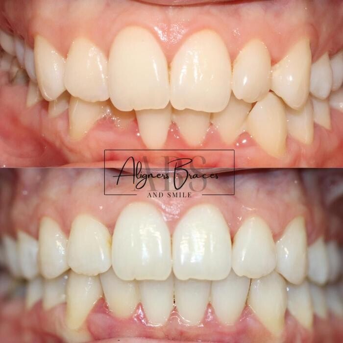 Images mydentist, Bristol Orthodontics, Kingswood, Bristol