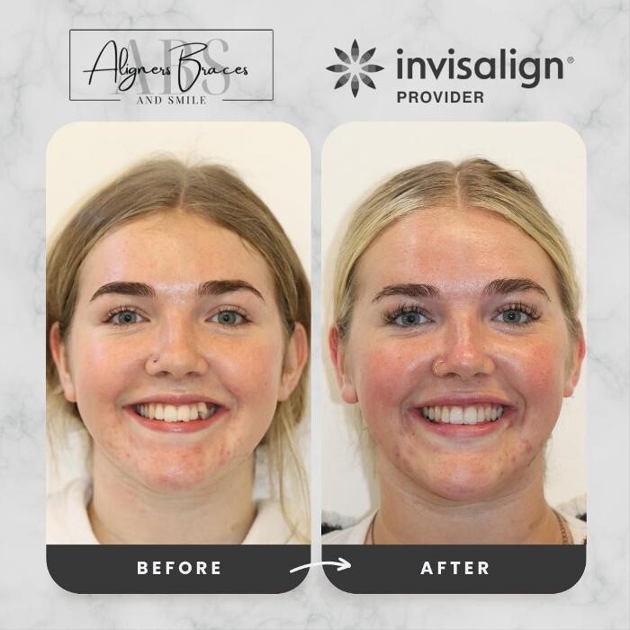 Images mydentist, Bristol Orthodontics, Kingswood, Bristol