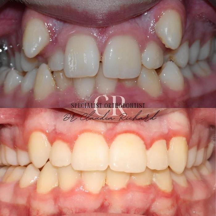 Images mydentist, Bristol Orthodontics, Kingswood, Bristol