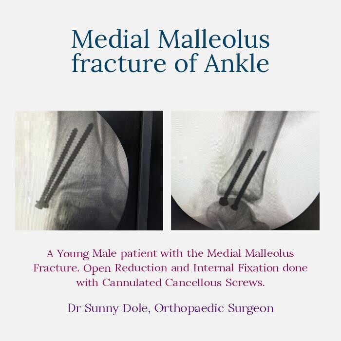 Images Dr. Sunny Dole | Orthopedic Surgeon