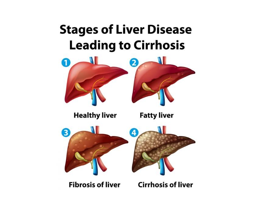 Images Dr. Sandeep Pal - Gastroenterologist in Chandigarh