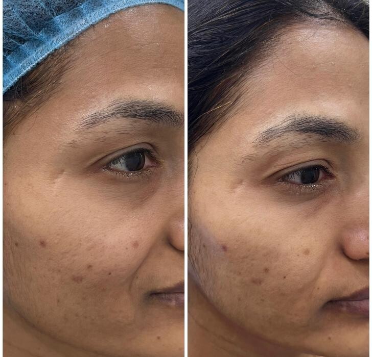 Images DERMADOCK Skin, Hair and Laser clinic - Best Dermatologist and Aesthetic clinic in Kokapet