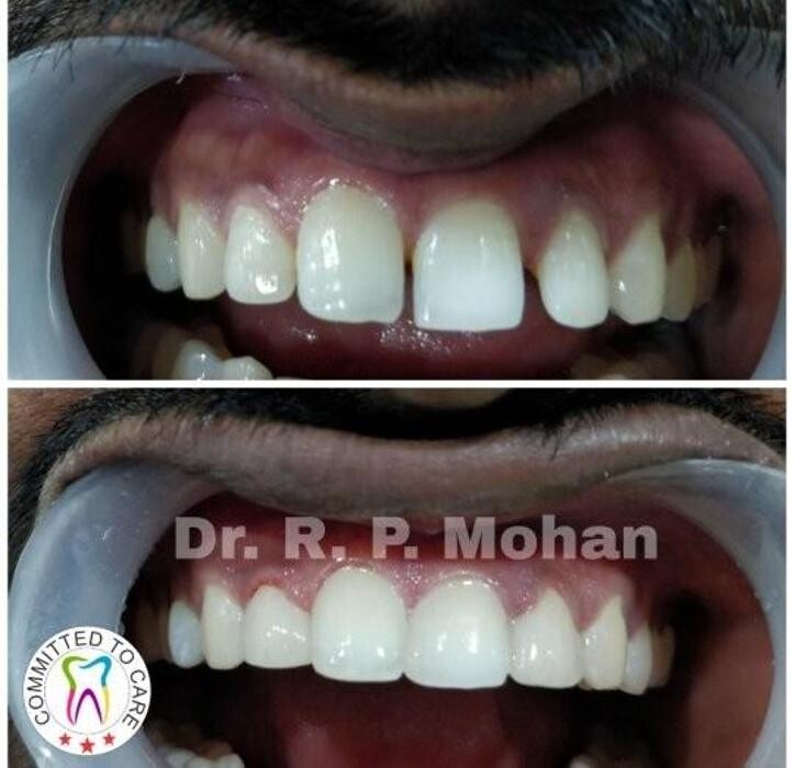 Images Mohan Dental Clinic - Kukatpally