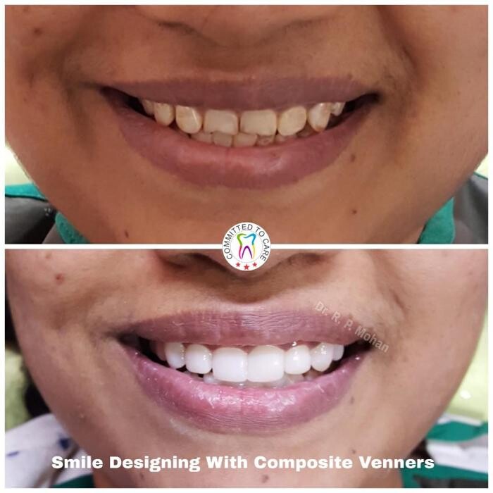 Images Mohan Dental Clinic - Kukatpally