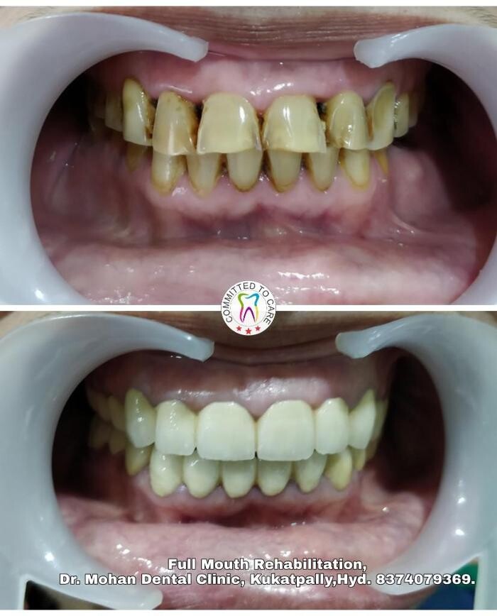 Images Mohan Dental Clinic - Kukatpally