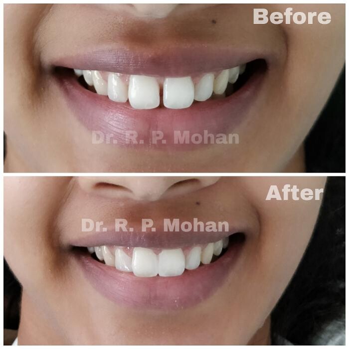 Images Mohan Dental Clinic - Kukatpally
