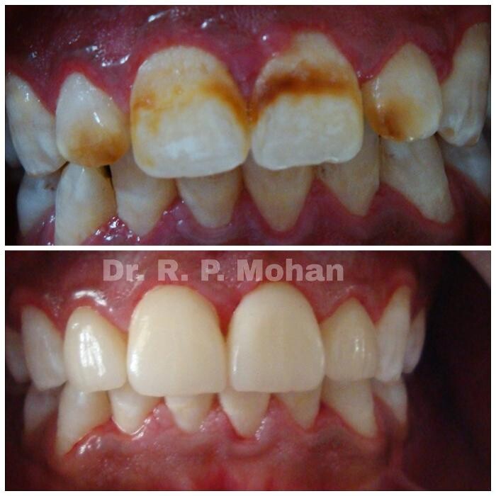 Images Mohan Dental Clinic - Kukatpally