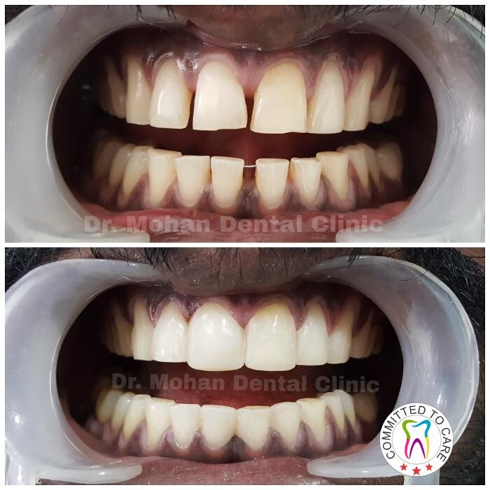 Images Mohan Dental Clinic - Kukatpally