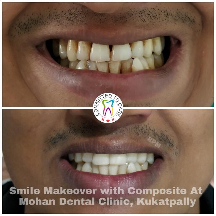 Images Mohan Dental Clinic - Kukatpally