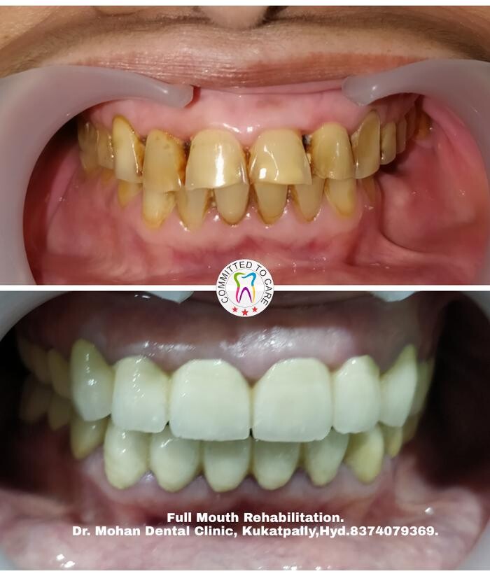 Images Mohan Dental Clinic - Kukatpally