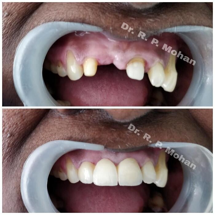 Images Mohan Dental Clinic - Kukatpally