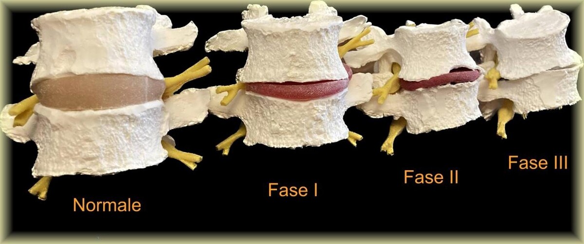 Images My Spine Design - Chiropratica