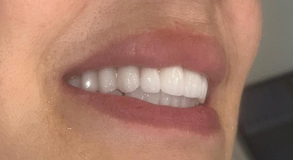 Images AGL Studio Dentistico del Dott. Adriano Guidi | Dentista Ancona