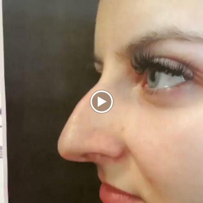 Images Dott. Carlo Alberto Pallaoro - Chirurgo estetico