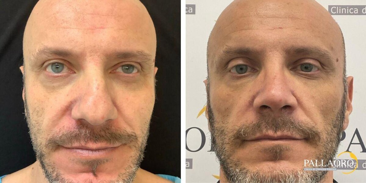 Images Dott. Carlo Alberto Pallaoro - Chirurgo estetico