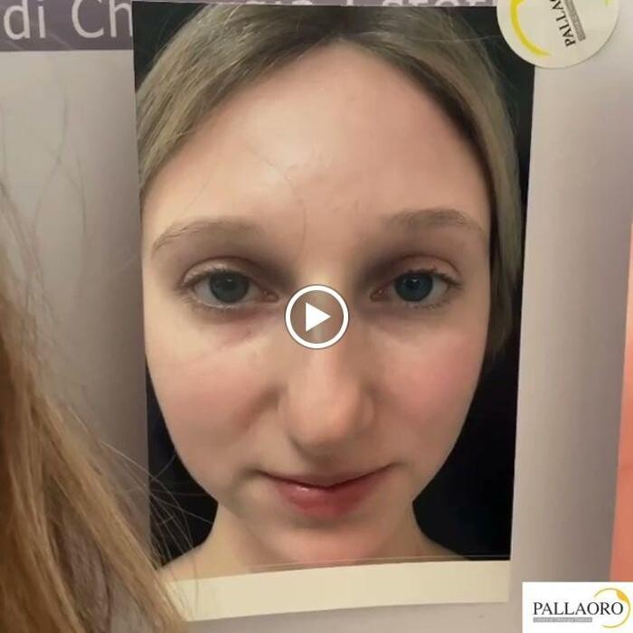 Images Dott. Carlo Alberto Pallaoro - Chirurgo estetico