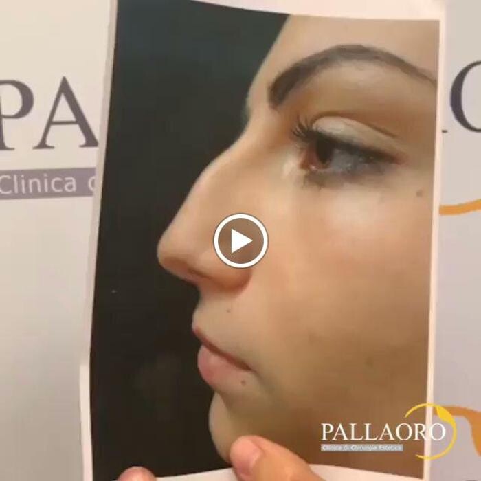 Images Dott. Carlo Alberto Pallaoro - Chirurgo estetico