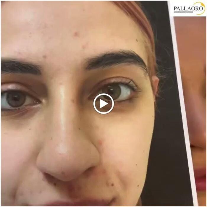 Images Dott. Carlo Alberto Pallaoro - Chirurgo estetico