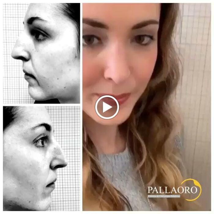 Images Dott. Carlo Alberto Pallaoro - Chirurgo estetico