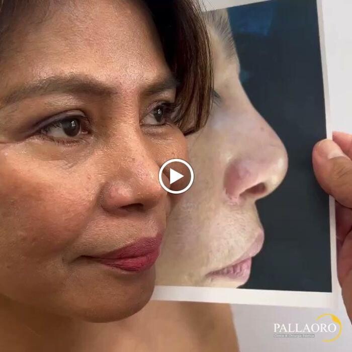 Images Dott. Carlo Alberto Pallaoro - Chirurgo estetico