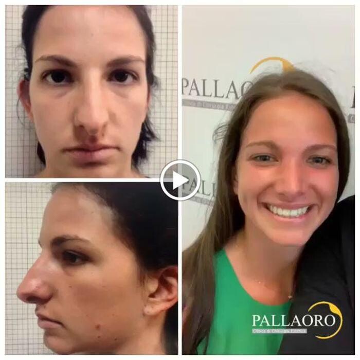 Images Dott. Carlo Alberto Pallaoro - Chirurgo estetico
