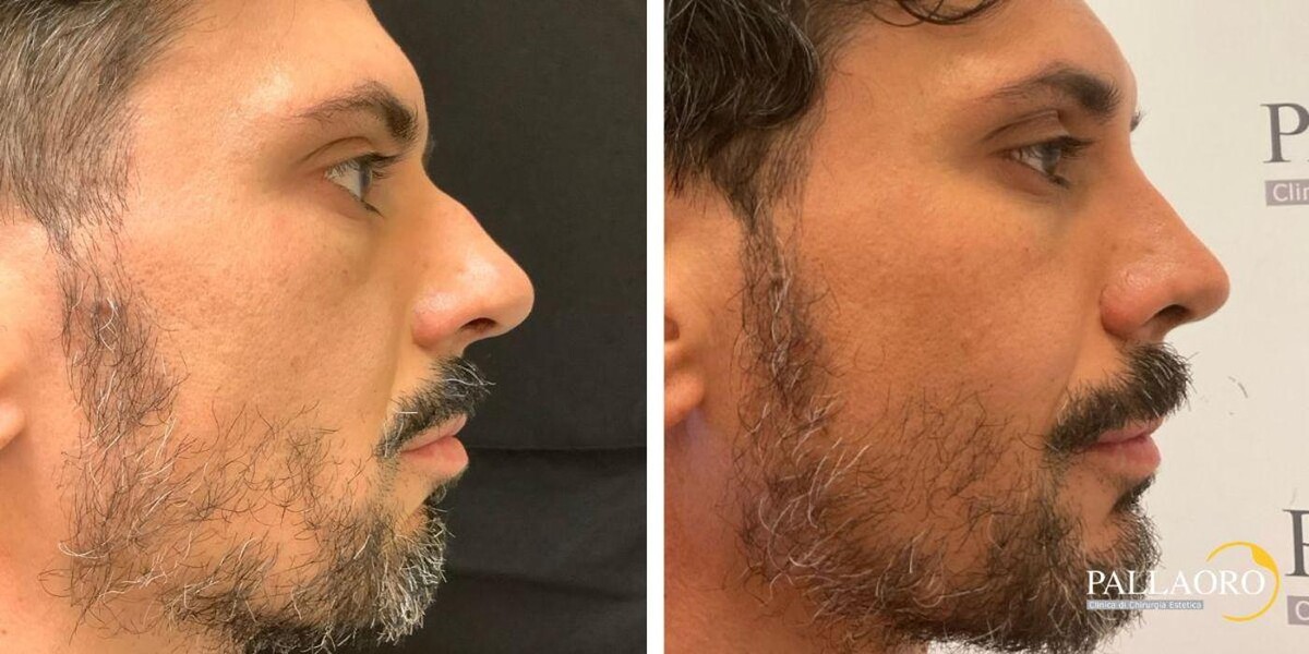 Images Dott. Carlo Alberto Pallaoro - Chirurgo estetico