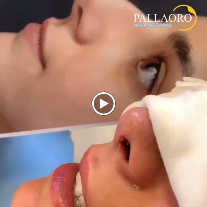 Images Dott. Carlo Alberto Pallaoro - Chirurgo estetico