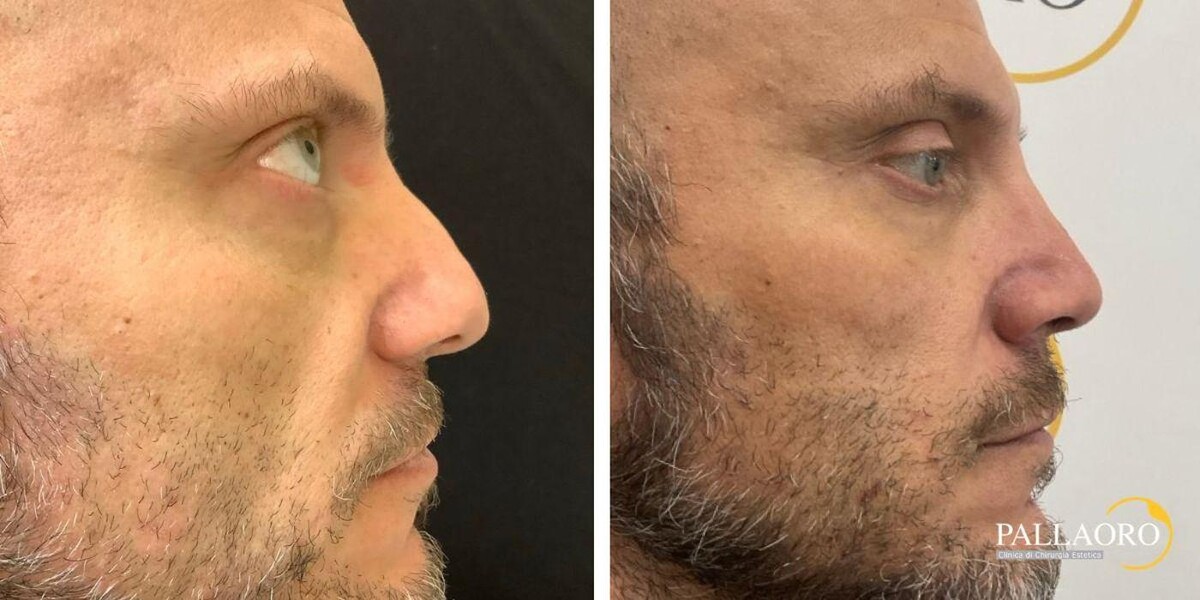 Images Dott. Carlo Alberto Pallaoro - Chirurgo estetico