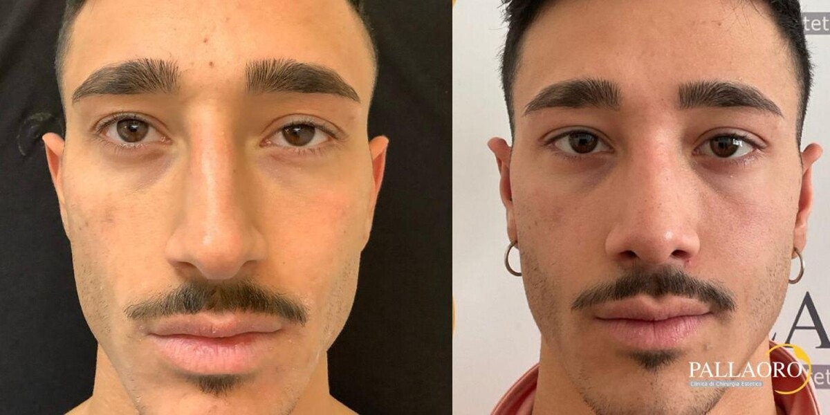 Images Dott. Carlo Alberto Pallaoro - Chirurgo estetico