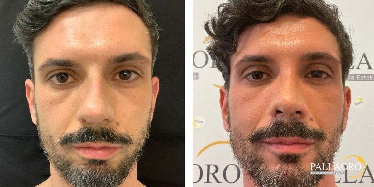 Images Dott. Carlo Alberto Pallaoro - Chirurgo estetico