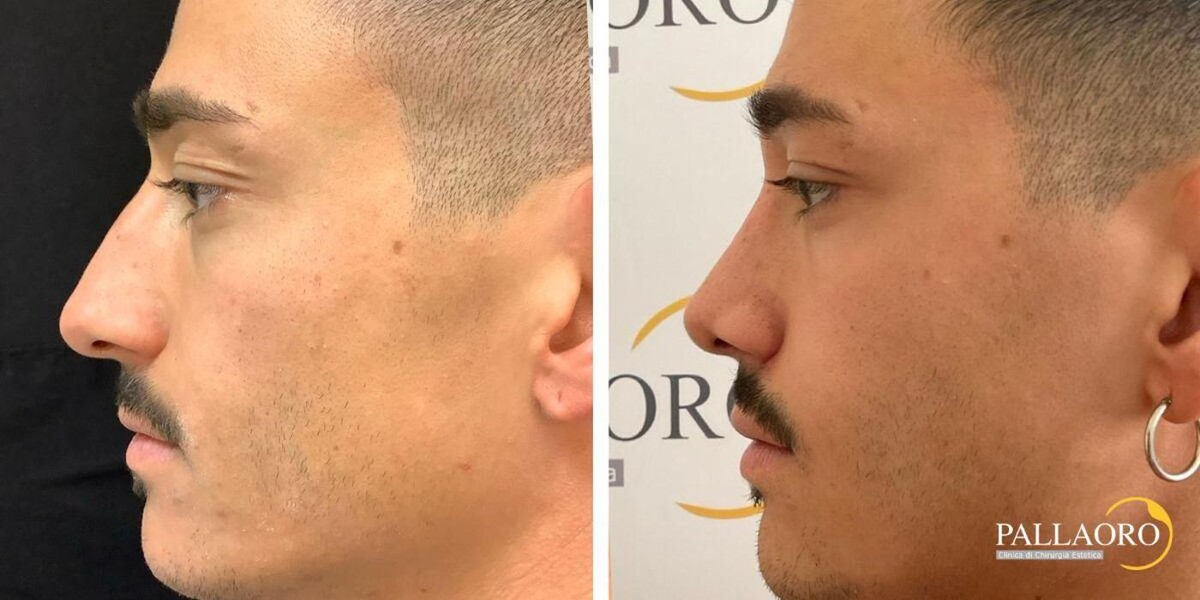 Images Dott. Carlo Alberto Pallaoro - Chirurgo estetico