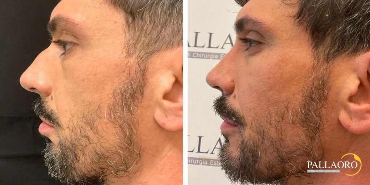 Images Dott. Carlo Alberto Pallaoro - Chirurgo estetico
