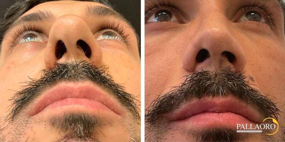 Images Dott. Carlo Alberto Pallaoro - Chirurgo estetico