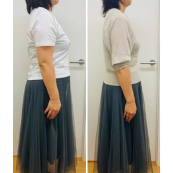 Images ダイエットサロン ChouChou 上通