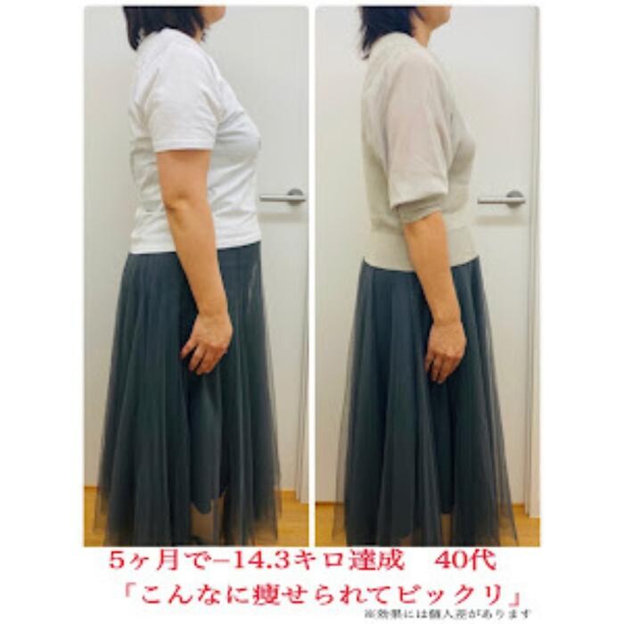 Images エステサロン ChouChou 山鹿