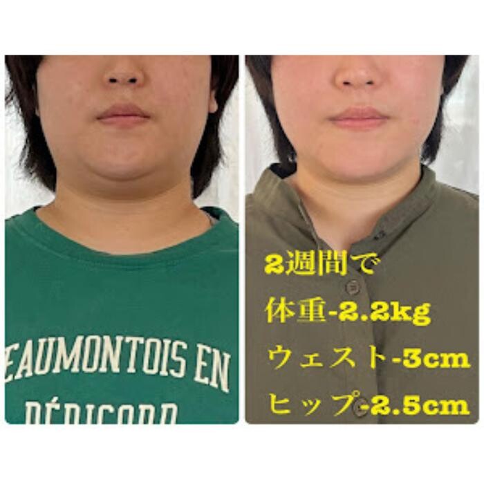 Images エステサロン ChouChou 山鹿
