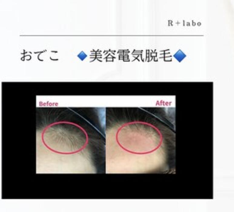Images Release Brow