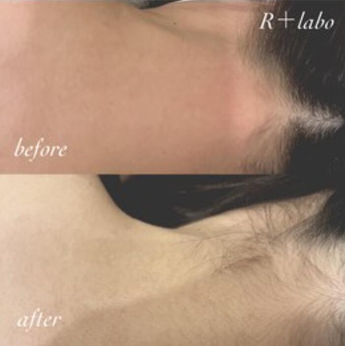 Images Release Brow