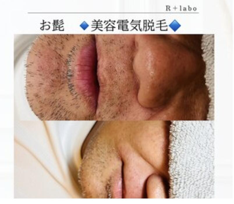 Images Release Brow