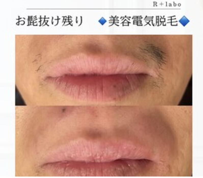 Images Release Brow