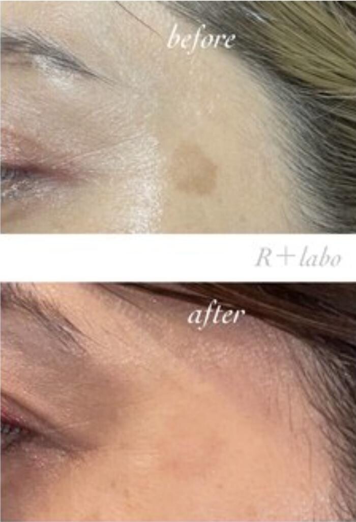 Images Release Brow