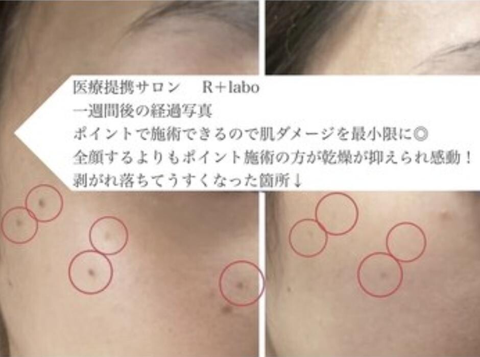 Images Release Brow