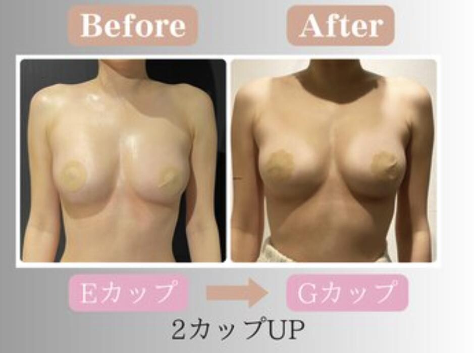 Images 【バストアップ・美尻】専門店 福岡天神 THE MORE０