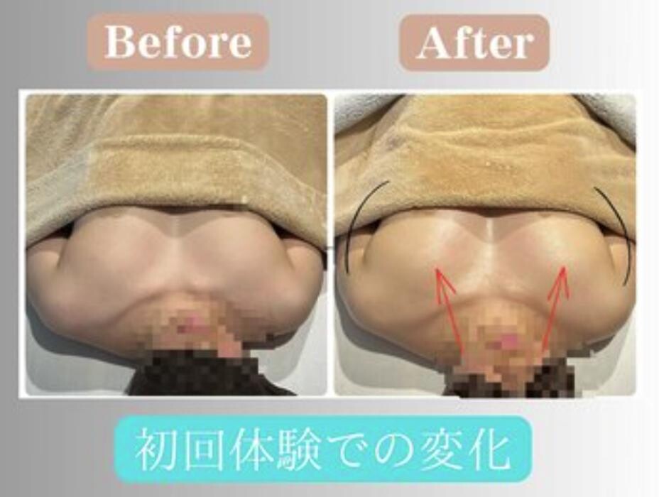 Images 【バストアップ・美尻】専門店 福岡天神 THE MORE０