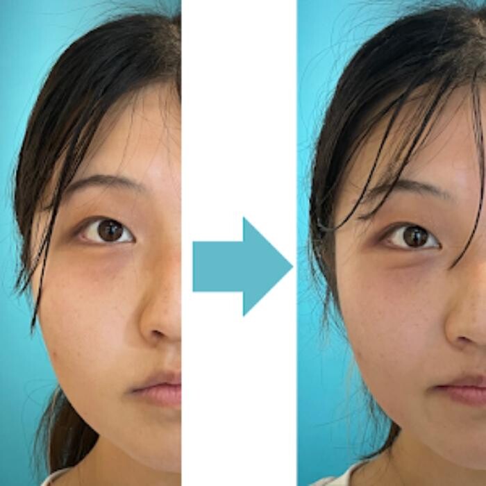 Images Nexfit for Beauty