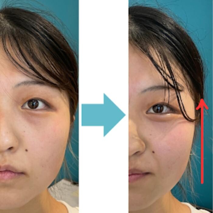 Images Nexfit for Beauty