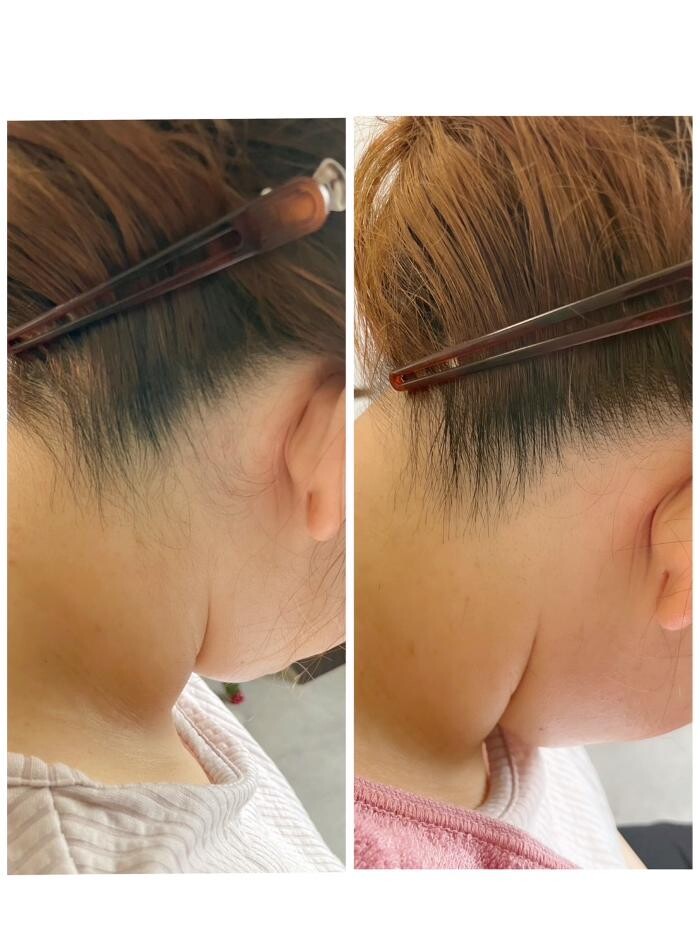 Images お顔そりとバザルトエステ凜