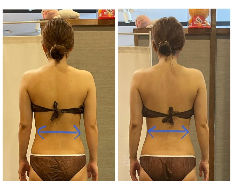 Images お顔そりとバザルトエステ凜