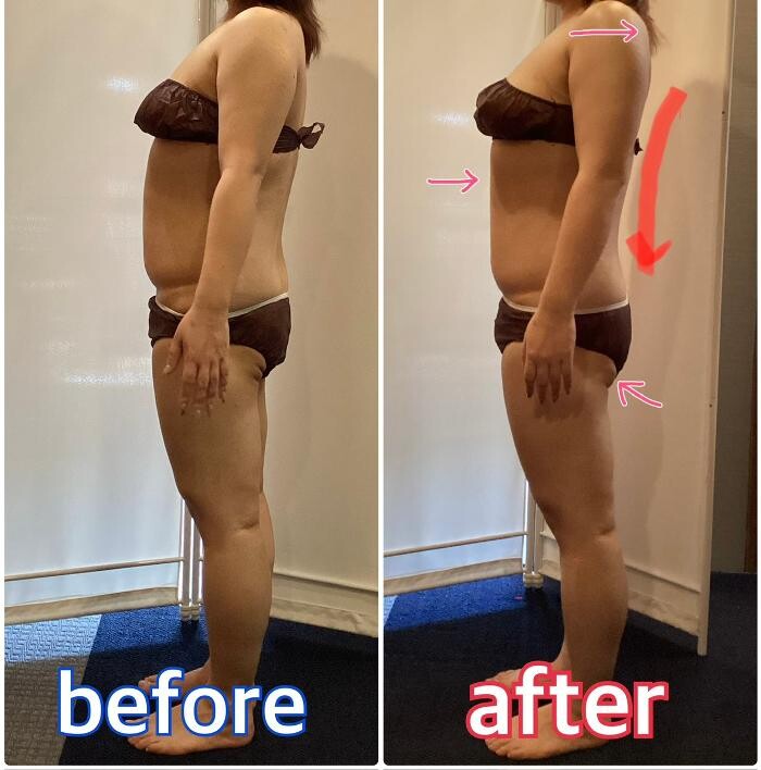 Images お顔そりとバザルトエステ凜