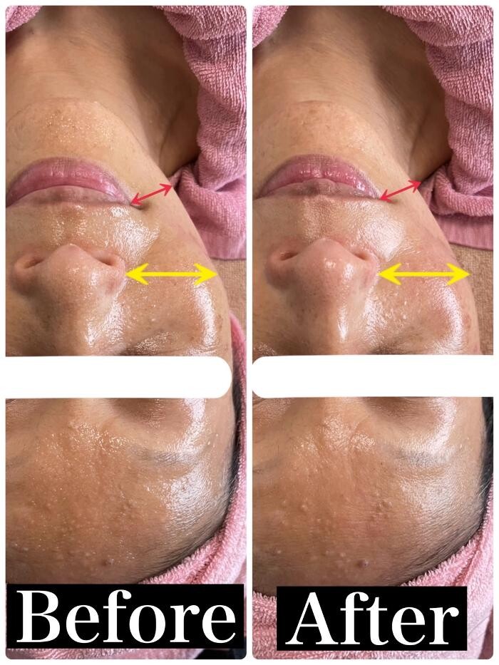 Images お顔そりとバザルトエステ凜